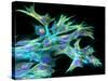 Fibroblast Cells, Fluorescent Micrograph-Dr. Torsten Wittmann-Stretched Canvas