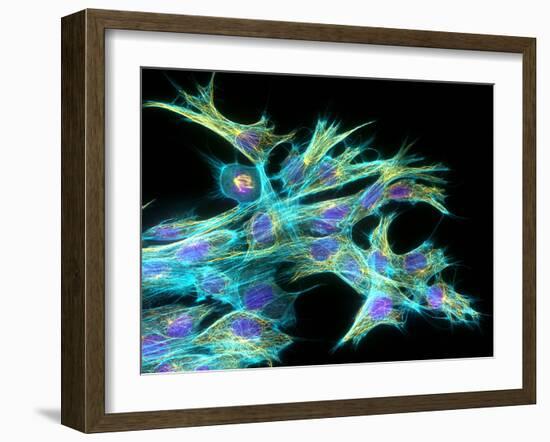 Fibroblast Cells, Fluorescent Micrograph-Dr. Torsten Wittmann-Framed Photographic Print