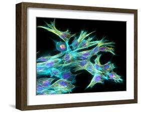 Fibroblast Cells, Fluorescent Micrograph-Dr. Torsten Wittmann-Framed Photographic Print