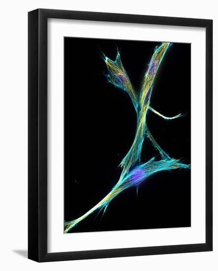 Fibroblast Cells, Fluorescent Micrograph-Dr. Torsten Wittmann-Framed Photographic Print