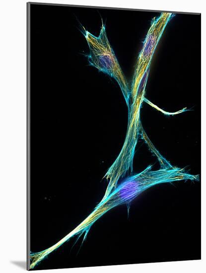 Fibroblast Cells, Fluorescent Micrograph-Dr. Torsten Wittmann-Mounted Photographic Print