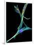 Fibroblast Cells, Fluorescent Micrograph-Dr. Torsten Wittmann-Framed Photographic Print