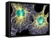 Fibroblast Cells Showing Cytoskeleton-Dr. Torsten Wittmann-Framed Stretched Canvas