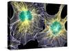 Fibroblast Cells Showing Cytoskeleton-Dr. Torsten Wittmann-Stretched Canvas