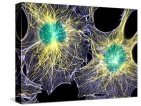 Fibroblast Cells Showing Cytoskeleton-Dr. Torsten Wittmann-Stretched Canvas