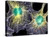 Fibroblast Cells Showing Cytoskeleton-Dr. Torsten Wittmann-Stretched Canvas