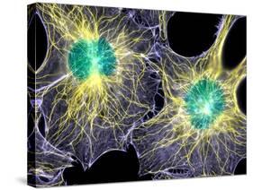 Fibroblast Cells Showing Cytoskeleton-Dr. Torsten Wittmann-Stretched Canvas