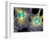 Fibroblast Cells Showing Cytoskeleton-Dr. Torsten Wittmann-Framed Premium Photographic Print