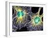 Fibroblast Cells Showing Cytoskeleton-Dr. Torsten Wittmann-Framed Premium Photographic Print