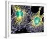 Fibroblast Cells Showing Cytoskeleton-Dr. Torsten Wittmann-Framed Photographic Print