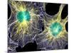 Fibroblast Cells Showing Cytoskeleton-Dr. Torsten Wittmann-Mounted Photographic Print