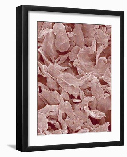 Fingernail-Micro Discovery-Framed Photographic Print