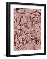Fingernail-Micro Discovery-Framed Photographic Print