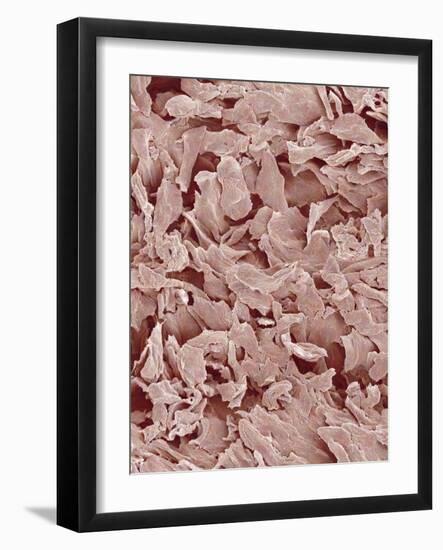 Fingernail-Micro Discovery-Framed Photographic Print