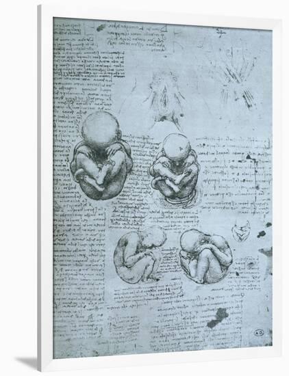 Five Views of a Foetus in the Womb, Facsimile Copy-Leonardo da Vinci-Framed Giclee Print