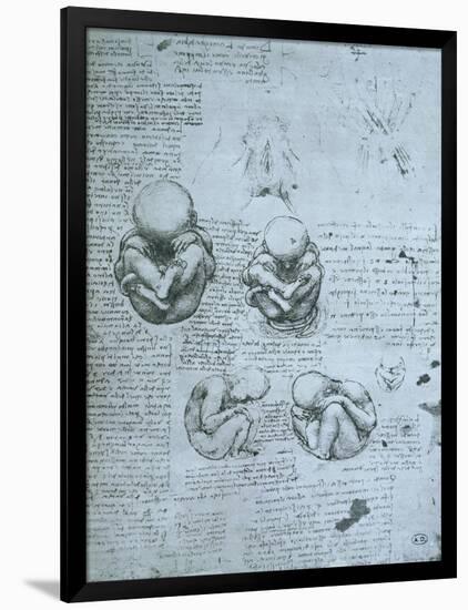 Five Views of a Foetus in the Womb, Facsimile Copy-Leonardo da Vinci-Framed Giclee Print