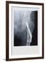 Fixed Femur-null-Framed Art Print