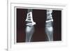 Fixed Tibia-null-Framed Premium Giclee Print