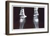 Fixed Tibia-null-Framed Art Print