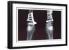 Fixed Tibia-null-Framed Art Print