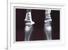 Fixed Tibia-null-Framed Art Print