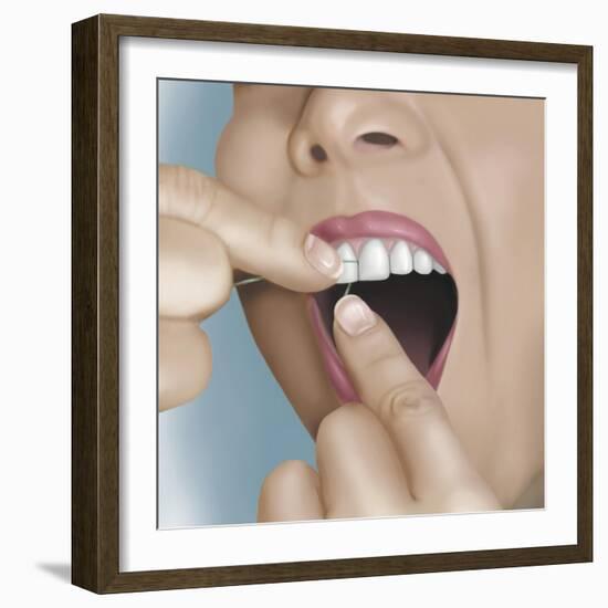 Flossing Between Front Teeth-null-Framed Art Print