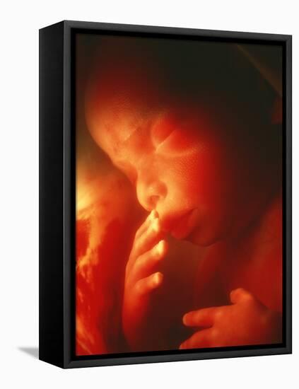 Foetus Aged 5 Months-Neil Bromhall-Framed Stretched Canvas