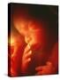 Foetus Aged 5 Months-Neil Bromhall-Stretched Canvas