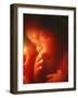 Foetus Aged 5 Months-Neil Bromhall-Framed Photographic Print