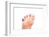 Foot Problems, Broken Toe and Calluses-soupstock-Framed Photographic Print