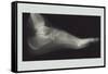 Foot-null-Framed Stretched Canvas