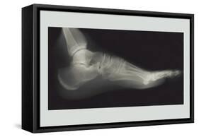 Foot-null-Framed Stretched Canvas