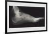 Foot-null-Framed Art Print