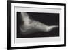 Foot-null-Framed Art Print