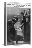 Forcible Feeding Through the Nose of Women Suffragist Prisoners-null-Stretched Canvas