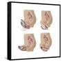 Four Methods of Female Contraception-null-Framed Stretched Canvas