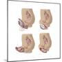 Four Methods of Female Contraception-null-Mounted Premium Giclee Print