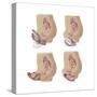Four Methods of Female Contraception-null-Stretched Canvas
