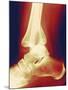 Fractured Ankle, X-ray-Miriam Maslo-Mounted Photographic Print