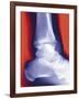 Fractured Ankle, X-ray-Miriam Maslo-Framed Photographic Print