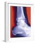 Fractured Ankle, X-ray-Miriam Maslo-Framed Photographic Print