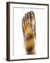 Fractured Foot, X-ray-Du Cane Medical-Framed Photographic Print