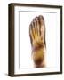 Fractured Foot, X-ray-Du Cane Medical-Framed Photographic Print