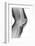 Fractured Kneecap, X-ray-Du Cane Medical-Framed Photographic Print