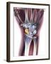 Fractured Wrist, X-ray-Du Cane Medical-Framed Photographic Print