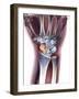 Fractured Wrist, X-ray-Du Cane Medical-Framed Photographic Print