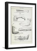 Fractures and Methods Of Bandaging.-Isabella Beeton-Framed Giclee Print