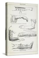 Fractures and Methods Of Bandaging.-Isabella Beeton-Stretched Canvas