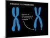 Fragile X Syndrome-Monica Schroeder-Mounted Giclee Print