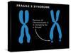 Fragile X Syndrome-Monica Schroeder-Stretched Canvas